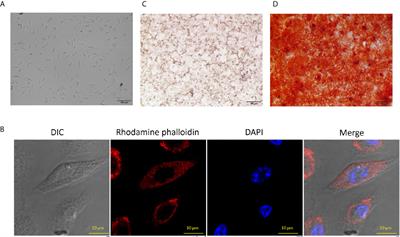 Cumulative Signaling Through NOD-2 and TLR-4 Eliminates the Mycobacterium Tuberculosis Concealed Inside the Mesenchymal Stem Cells